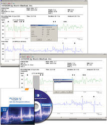 Λογισμικό Οξυμετρίας Nonin nVISION®
