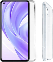 Volte-Tel Slimcolor Air Transparene (Xiaomi Mi 11 Lite / 11 Lite 5G / 11 Lite 5G NE) Volte-Tel Slimcolor Air Transparene (Xiaomi Mi 11 Lite / 11 Lite 5G / 11 Lite 5G NE)