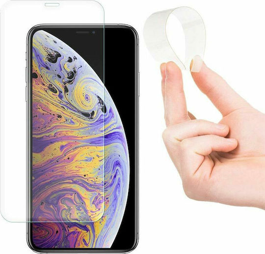 Hydrogel Screen Protector (Galaxy Note 10 Lite)