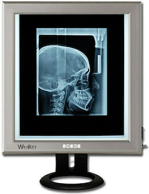 Gima Ultra Slim Led 42x36cm Diaphanoscope