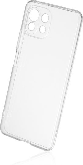 Naxius 1mm Back Cover Σιλικόνης 1mm Διάφανο (Xiaomi Mi 11 Lite / 11 Lite 5G / 11 Lite 5G NE)