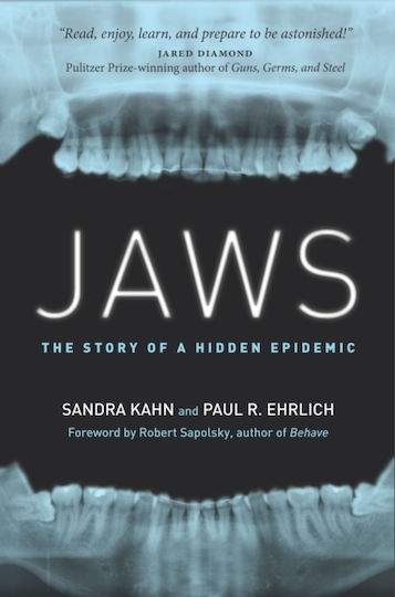 Jaws