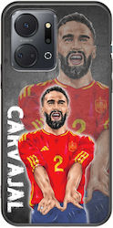 Euro 2024 Dani Carvajal Honor X7a Black Tpu Black Silicone Euro 2024 Dani Carvajal Honor X7a Black Tpu Black Silicone