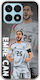 Euro 2024 Emre Can Ehre X8a Flexible Tpu Transparentes Silikon