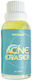 All About Eve Acne Eraser Λοσιόν Προσώπου κατά της Ακμής 30ml