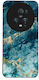 Sonique Marble Series Case for Honor Magic5 Pro...