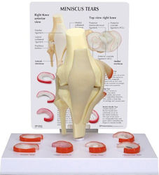 3b Scientific Appendages & Joints Model