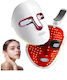 LED & Infrarot gegen Akne ONLINEGADGET-270959