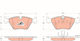 Trw Gdb1404 Brake Pad Set Disc Brake