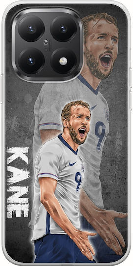 Euro 2024 Harry Kane Xiaomi 15t 5g Гъвкав TPU Прозрачен Силикон