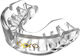 Opro Gold Level Self-Fit Youth Mouthguard Clear