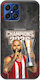 Kings Europe 2026 French Sniper Honor X8 Black TPU Silicone Case
