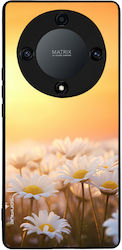 Sonique Back Cover Σιλικόνης Χρυσό (Honor Magic...