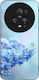 Sonique Back Cover Σιλικόνης Μπλε (Honor Magic5...