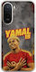 Θήκη World Stars Collection Lamine Yamal Xiaomi Redmi A7 Pro Flexible Tpu Διάφανη Σιλικόνη