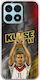 World Stars Collection Case Miroslav Klose Honor X8a Flexible TPU Transparent Silicone