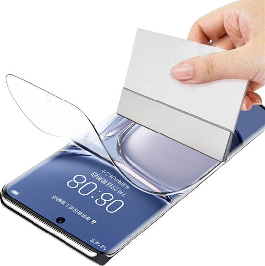 Sunshine Hydrogel Screen Protector (Moto G47) 9909