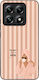 Sonique Stripe Stories Series Xiaomi Xiaomi 14t...