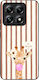 Sonique Stripe Stories Series Xiaomi Xiaomi 14t...