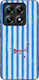 Sonique Stripe Stories Series Xiaomi Xiaomi 14t...