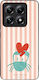 Sonique Stripe Stories Series Xiaomi Xiaomi 14t...