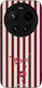 Sonique Stripe Stories Series Xiaomi Xiaomi 17 ...