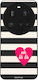 Sonique Stripe Stories Series Xiaomi Xiaomi 15 ...