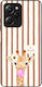 Sonique Stripe Stories Series Case Xiaomi Poco ...