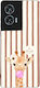 Sonique Stripe Stories Series Motorola Edge 50 ...
