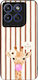 Sonique Stripe Stories Series Case Motorola Edg...