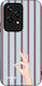 Husă Sonique Stripe Stories Series Honor 200 Li...