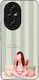 Husă Sonique Stripe Stories Series Honor 200 Pr...