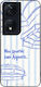 Θήκη Sonique Stripe Stories Series Honor 90 Sma...