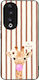 Husă Sonique Stripe Stories Series Honor 90 5g ...