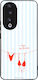 Husă Sonique Stripe Stories Series Honor 90 5g ...