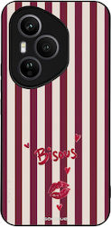 Sonique Stripe Stories Series Honor 400 Pro 5G ...