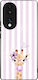 Калъф Sonique Stripe Stories Series Honor 70 5g...