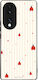 Калъф Sonique Stripe Stories Series Honor 70 5g...