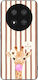 Θήκη Sonique Stripe Stories Series Honor Magic7...