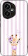 Husă Sonique Stripe Stories Series Honor 400 5g...