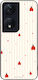 Θήκη Sonique Stripe Stories Series Honor 90 Sma...
