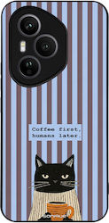 Sonique Stripe Stories Series Honor 400 Pro 5G ...