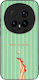 Sonique Stripe Stories Series Honor Magic8 Pro ...