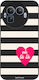 Sonique Stripe Stories Series Case Realme GT 8 ...