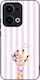 Θήκη Sonique Stripe Stories Series Oppo Reno13 ...