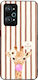 Sonique Stripe Stories Series Series Handyhülle...