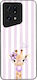 Sonique Stripe Stories Series Case Oppo Find X5...