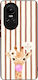 Sonique Stripe Stories Series Oppo Reno10 5g Br...