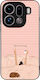 Sonique Stripe Stories Series Case Oppo Find X9...