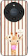 Sonique Stripe Stories Series Honor Magic8 Lite...